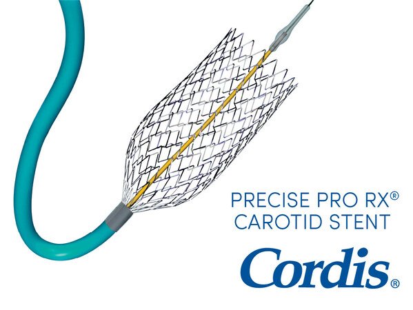 The Cordis PRECISE PRO RX® Carotid Stent System, one of the most implanted carotid stent systems, has been demonstrated to deliver excellent outcomes as proven by an extensive body of clinical evidence.